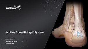 Achilles SpeedBridge™ System
