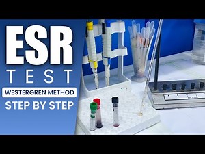 How to Perform ESR Test Step by Step | Westergren Method Tutorial | MedilabLife