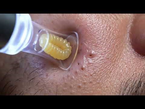 Pore Vacuum & Blackhead Extraction (AI Simulation) for Deep Sleep 😴 | GIGA LAB