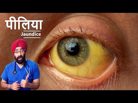 Yellow Eyes & Skin | Jaundice | Reason to Cure | Dr.Education