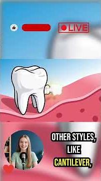 Fixed Teeth Replacement: Your Dental Bridge Guide