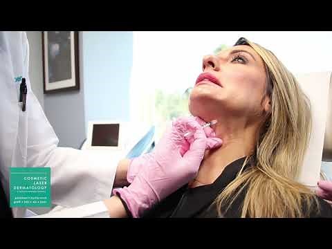 Platysmal Neck Band Treatment: Botox Demonstration by Dr. Monica Boen