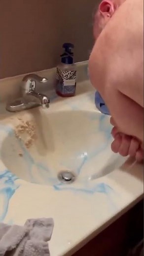 GIANT arm cyst explosion at home