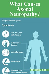 What causes axonal neuropathy? - TimesMojo