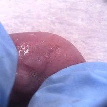 Vídeo: Injeções intravenosas em camundongos neonatais