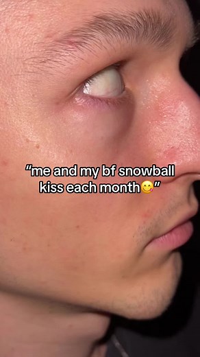 What is a Snowball Kiss on TikTok? Explained