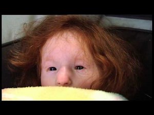 Extraordinary People: The Tiniest Girl In The World