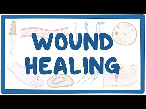 Wound healing