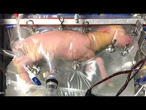 Baby sheep successfully grown in artificial 'biobag' womb