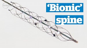 The 'holy grail' of creating movement via thought may about to be realised, thanks to a stent the size of a paper clip that can be implanted into brains of paralysed patients. | The Sydney Morning Herald