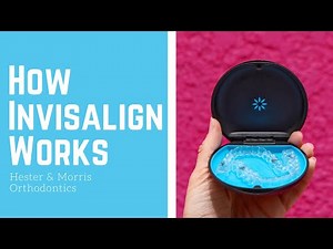 How Invisalign Works