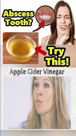 Ease Tooth Abscess Pain Fast 🔥 Home Remedy