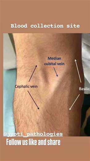 # Blood collection site of veins # semple collection # pathology lab