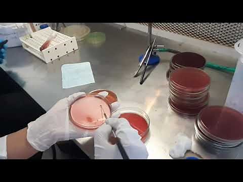 Stool Culture test procedure in Microbiology
