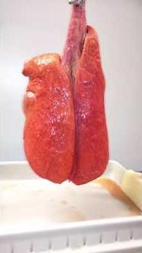 Lung Protective Ventilation