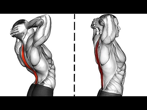 10 Exercises to Improve Posture and Relieve Lower Back Pain