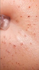 “You Won’t Believe How Clean This Vacuum Line Looks… WOW!”