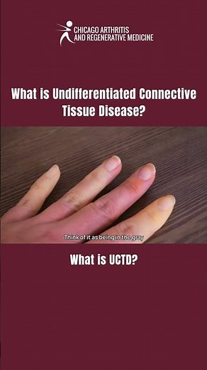What is UCTD (Undifferentiated Connective Tissue Disease)? #Rheumatology #RegenerativeMedicine