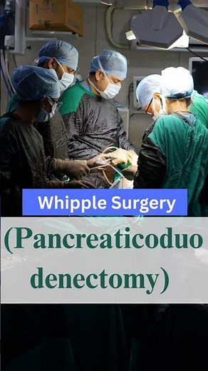 whipple surgery (Pancreaticoduodenectomy)