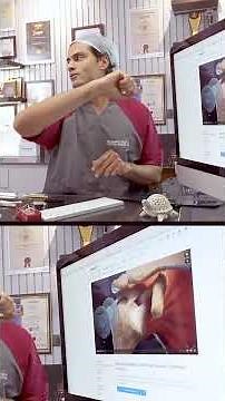 How to Identify a Rotator Cuff Tear? Signs & Diagnosis Explained! #shoulder