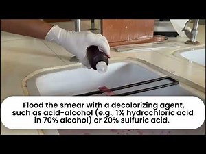 Ziehl-Neelsen (ZN) Staining / Acid-Fast Staining Procedure