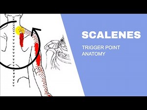 Scalenes Trigger Points