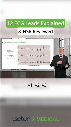 ECG Leads & NSR Explained