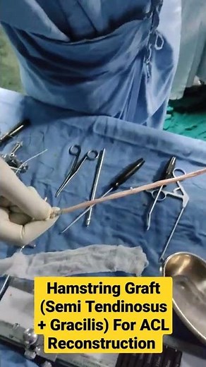 Hamstring Graft (Semi Tendinosus + Gracilis) For ACL Reconstruction ...Dr Sai Chandra