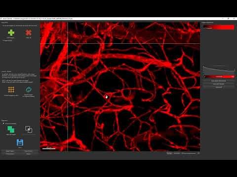 Introduction to stitching large datasets in Imaris Stitcher