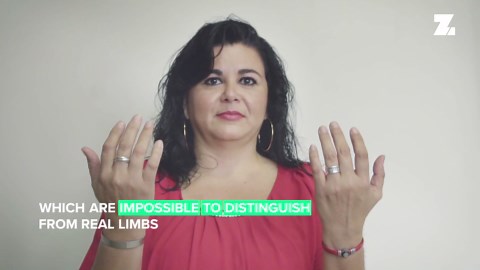 These prostheses are helping people live their best lives