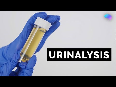 Urinalysis | Urine Dipstick Test | OSCE Guide | UKMLA | CPSA | PLAB 2