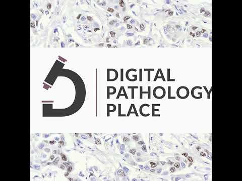 175: Deploying Digital Pathology Tools - Challenges and Insights with Dr. Andrew Janowczyk