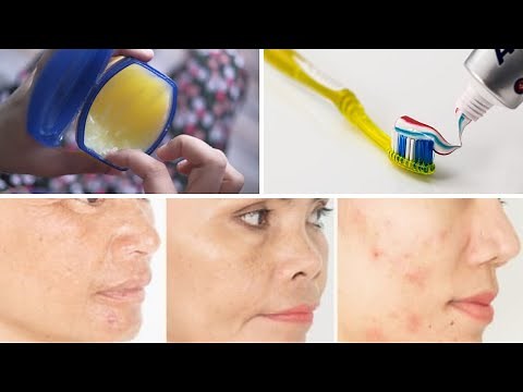 how to use colgate and vaseline to get rid of dark spots on the face