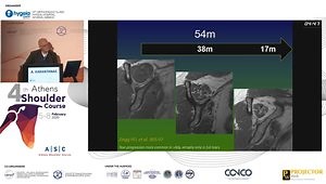 MRI Evolution of a Rotator Cuff Tear: Why it Is Critical for Optimizing Treatment