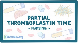 Coagulation studies - Partial thromboplastin time (PTT): Nursing: Video & Causes | Osmosis