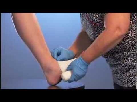 Spiral Wrap Procedure