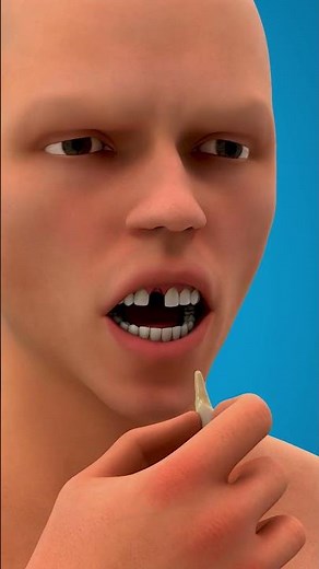 What to Do Immediately If Your Tooth Falls Out #toothless