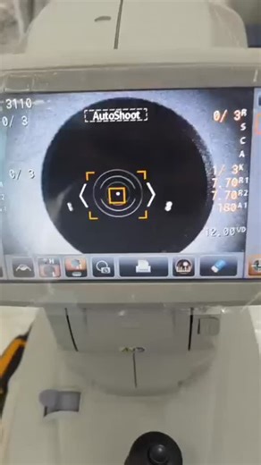 Refractionist _YasirButt on Instagram: "Auto Refractometer.. An Autorefractometer (also called Auto Refractor) is a computerized machine used in eye clinics to measure the refractive error of the eyes automatically — that is, it estimates whether a person needs spectacles for myopia (minus power), hypermetropia (plus power), or astigmatism (cylinder power). --- 🔹 How it works 1. The patient sits and looks into the machine at an image (usually a hot-air balloon or farmhouse). 2. Infrared light e