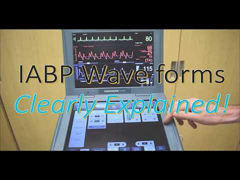 IABP Waveforms