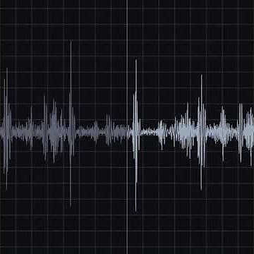 Pericardial Friction Rub Recording & Waveform | Eko Health