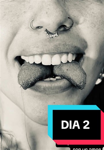 DIA 2 ❤️‍🩹 Tongue Split #tonguesplit #modificacioncorporal #bifurcaciondelengua #lenguabifida #recuperacionbifida