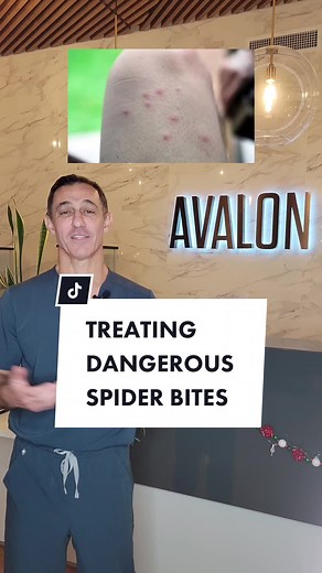 Even if mild, spider bites can be pretty scary 🕷️. Here's the 2 most dangerous spider bites you can get and what you need to know! #spiderbites #askthedoctor #spiderbites #blackwidow #sborwnrecluse #healing #themoreyouknow #fyp #foryoupage