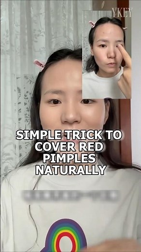 Simple Trick to Cover Red Pimples Naturally