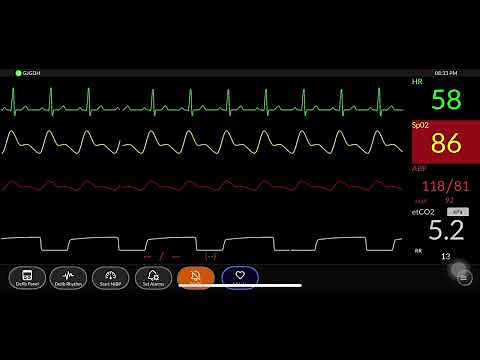 Simpl Simulated Patient Monitor