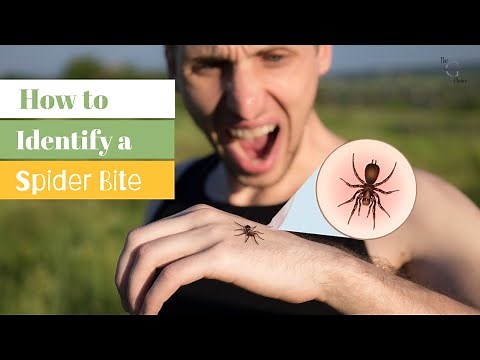Identifying Spider Bites: How to Recognize and Treat Spider Bite Symptoms | The Guardians Choice
