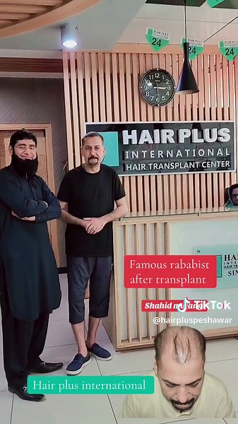 Hair Restoration Journey at KPK University Mall