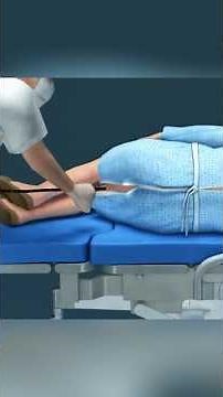 Understanding Colonoscopy: Tips for a Smooth Experience