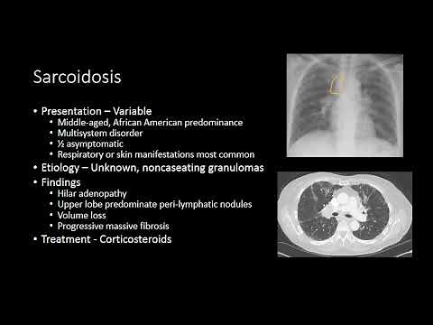 Chest Radiology - Imaging of Interstitial and Diffuse Disease