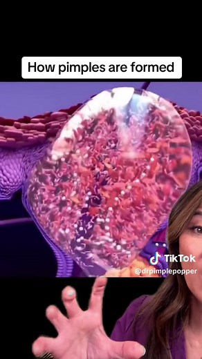 Sandra Lee, MD on TikTok