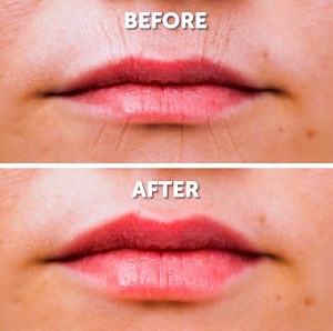 14M views · 27K reactions | 11 effective facial rejuvenation exercises.  | Bright Side | Facebook